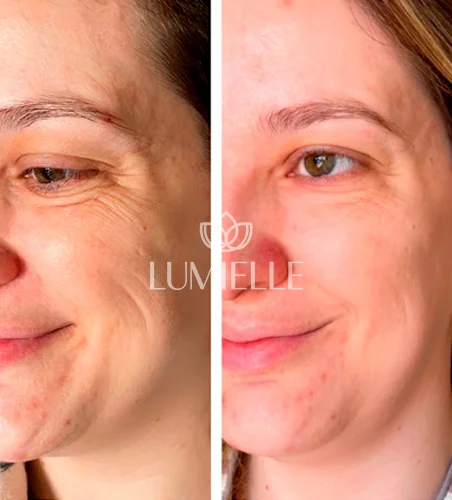 LUMIELLE-PRV-1.webp
