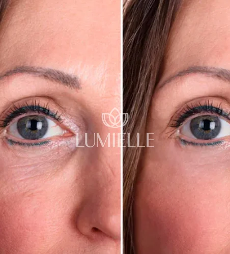 LUMIELLE-PRV-5-1.webp