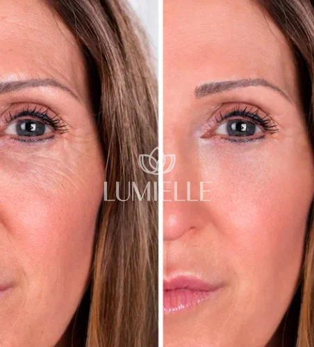 LUMIELLE-PRV-7-1.webp