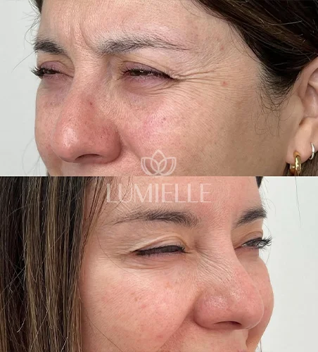 LUMIELLE PRV 11
